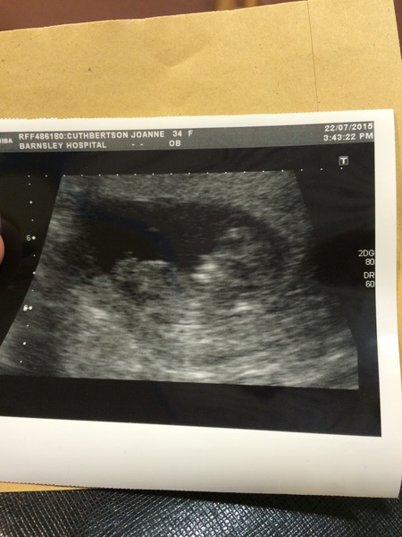 February 2016 Babies - The time for scans is fast approaching!