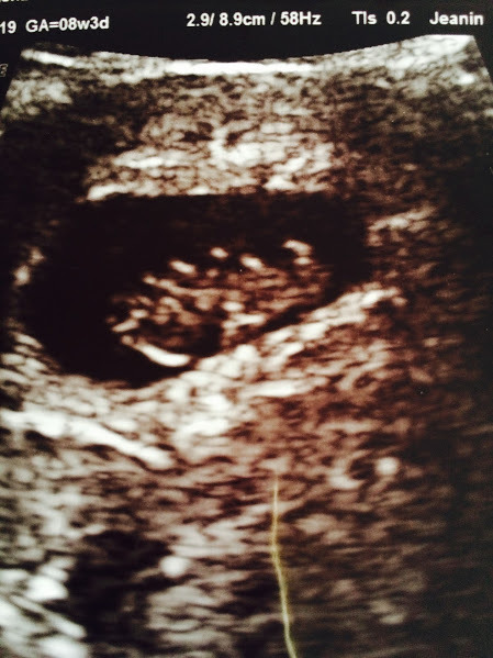 February 2016 Babies - The time for scans is fast approaching!