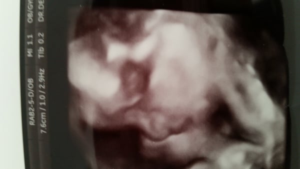 October baby bus take 4! 20wk scans and big pram buying plans!