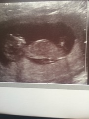 12 week scan boy or girl?