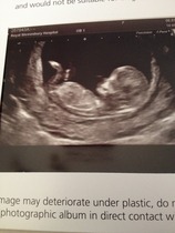 Jan 2016 #5 - Scanxiety, sickness and sweet relief as we approach the second trimester!