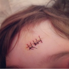Any hints/tips to prevent scarring (DDs forehead deep cut)