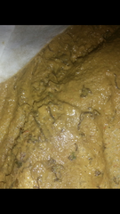 taadaa shiny new gastrostomy support thread no.3 tube feeding support