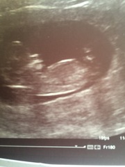 12 week scan boy or girl?