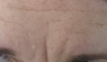 What can I do about this crack?! Pic Attached