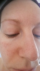 Argh, pores! (with pics)