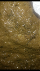 taadaa shiny new gastrostomy support thread no.3 tube feeding support