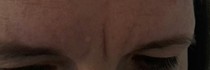What can I do about this crack?! Pic Attached