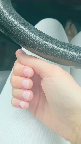 Disgusting nails (pics)