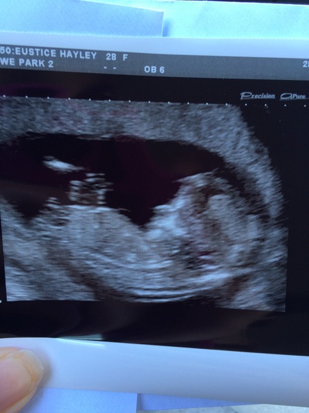 Second or subsequent babies due Jan/Feb/March 2016