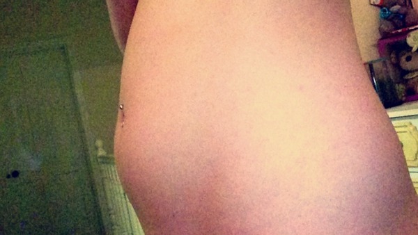 Bump or bloat?