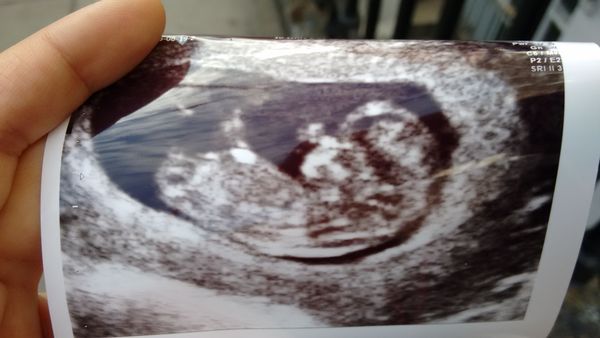 March 2016 Babies!! Our Grape-sized babies are getting Bigger!