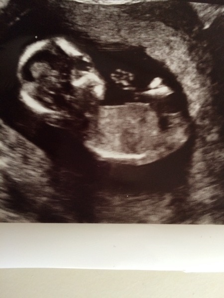 Nub and skull theory guessing??