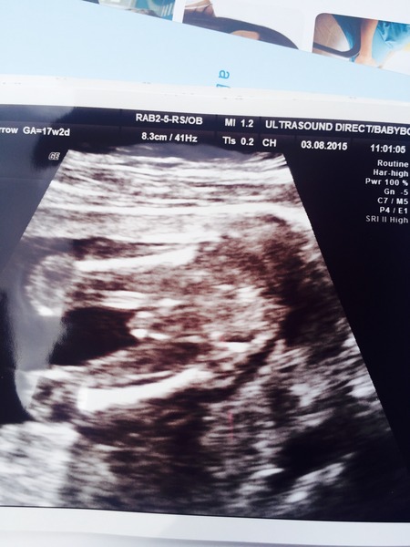 Jan 2016 #7 - headaches and exhaustion but 1/3 through