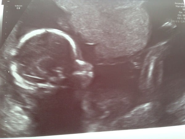 Christmas and New Year's Babies - thread 2 (20w scans right around the corner)