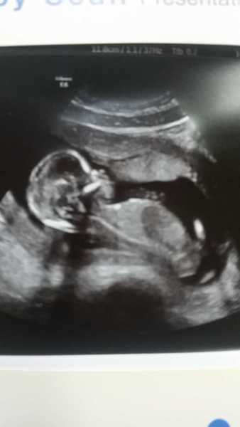 Second or subsequent babies due Jan/Feb/March 2016