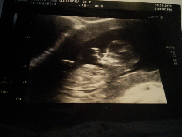 February '16 approaching and conquering the 12 week mark!