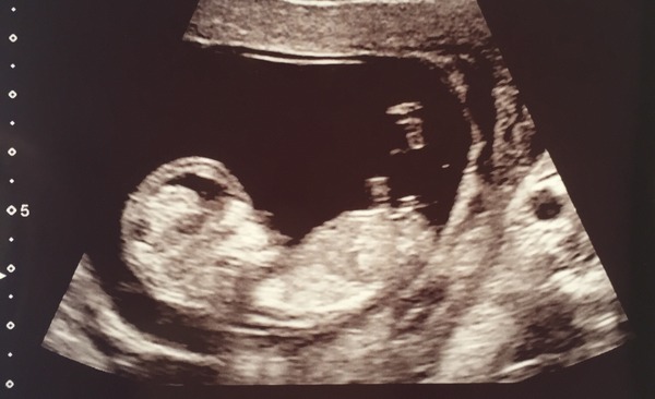 Gender guess?