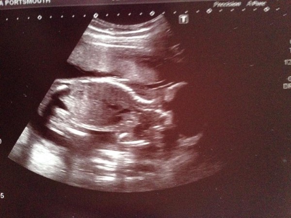 Christmas and New Year's Babies - thread 2 (20w scans right around the corner)