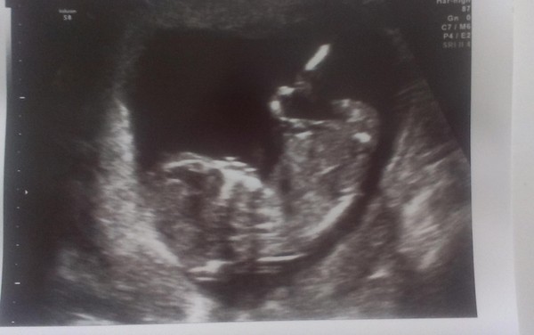 February '16 approaching and conquering the 12 week mark!