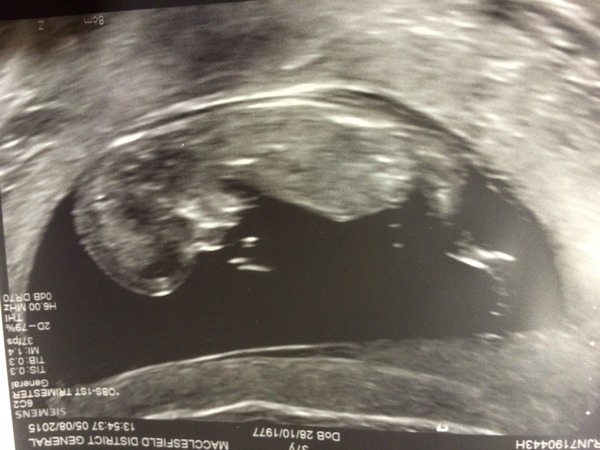 February '16 approaching and conquering the 12 week mark!