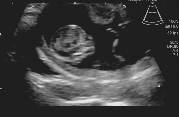 February '16 approaching and conquering the 12 week mark!