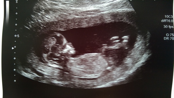 February '16 approaching and conquering the 12 week mark!