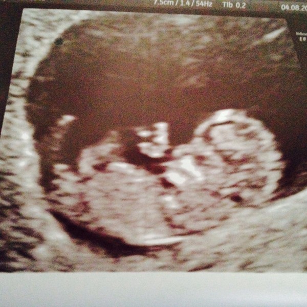 Due February 2016 - first timers