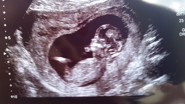 February '16 approaching and conquering the 12 week mark!