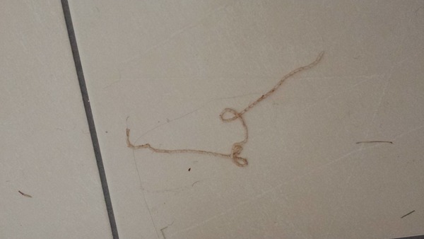 What is this?! (A bit gross)