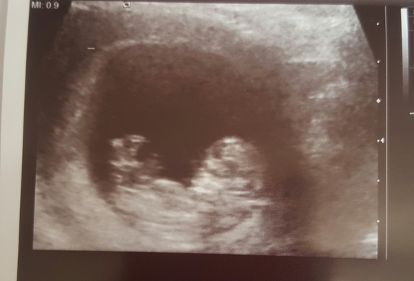 any gender guesses