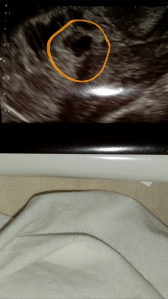 March 2016 Babies!! Our Grape-sized babies are getting Bigger!