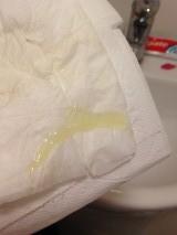 Mucus Plug or remains of EPO...?? (Sorry TMI)