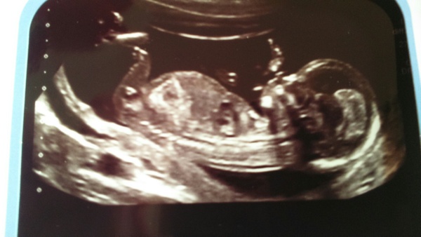 February '16 approaching and conquering the 12 week mark!