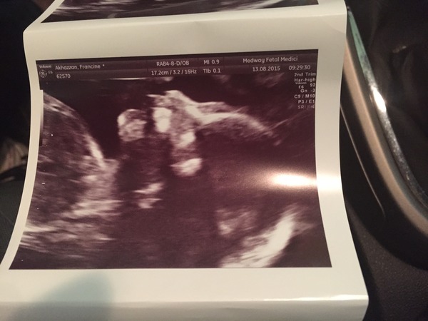 Christmas and New Year's Babies - thread 2 (20w scans right around the corner)