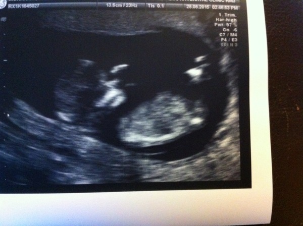 March 2016 Babies!! Our Grape-sized babies are getting Bigger!