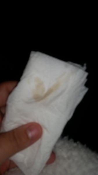 *GROSS PICTURE* 10 weeks.. and not sure what to make of when I wiped..