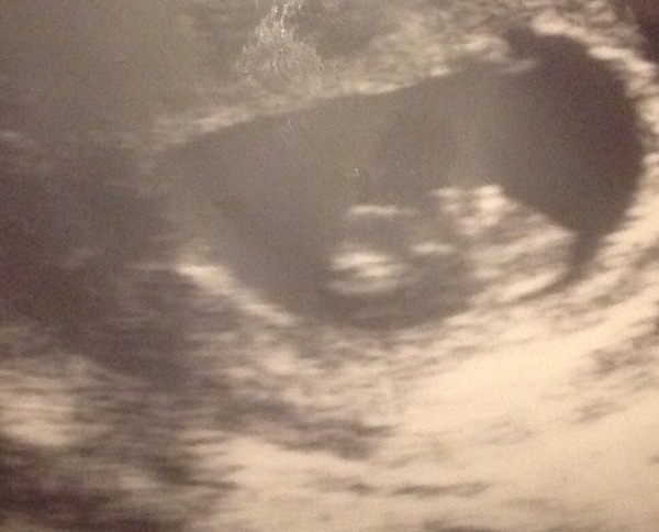 March 2016 Babies!! Our Grape-sized babies are getting Bigger!