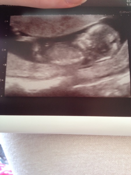 February '16 approaching and conquering the 12 week mark!