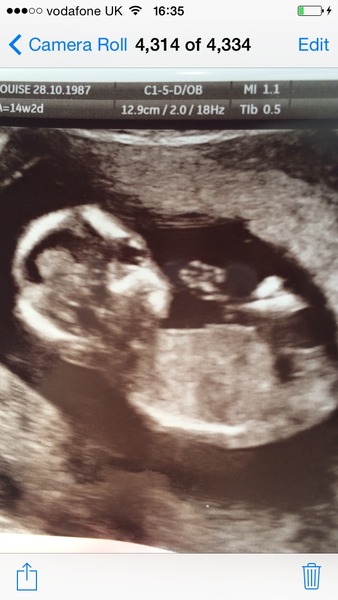 Jan 2016 #6 ....bumps and blooming ahoy!