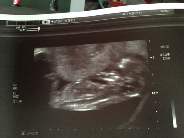 February '16 approaching and conquering the 12 week mark!