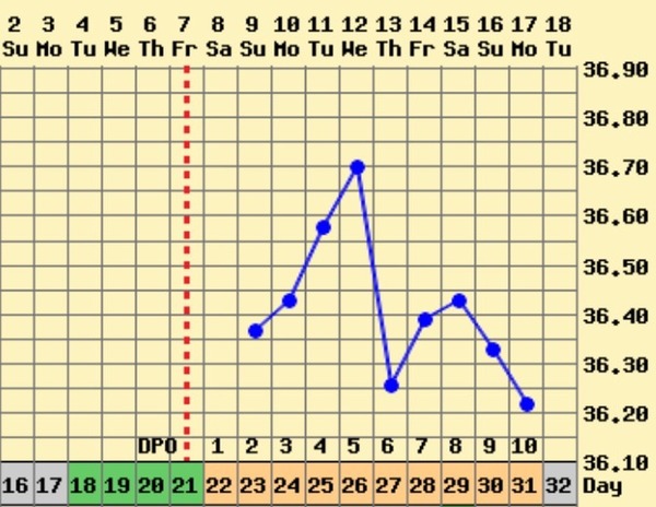 Short Luteal Phase