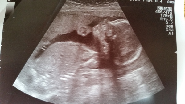 Christmas and New Year's Babies - thread 2 (20w scans right around the corner)