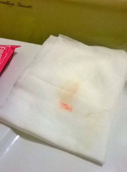 TTC after MC (#7) - fx for better times ahead