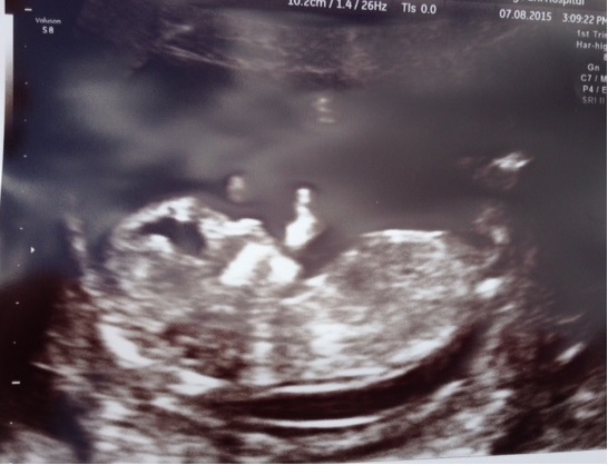 February '16 approaching and conquering the 12 week mark!