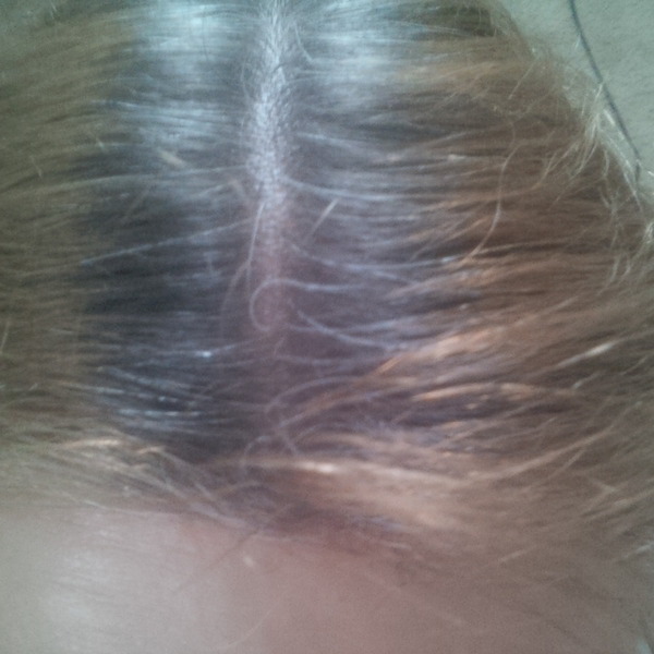 For those of us going grey