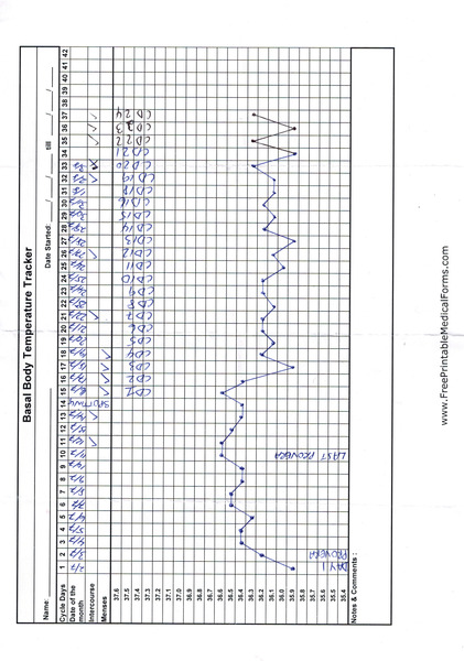 bbt charting