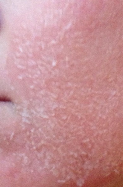 Obagi. Anyone used them?