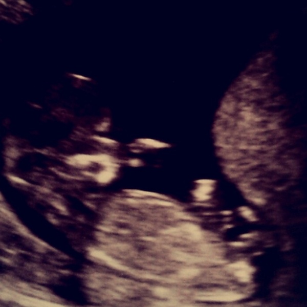 scan