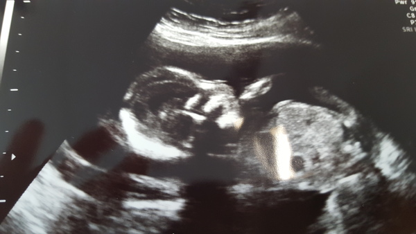 We're growing babies, stomach beards and nipple pubes - it's pregnancy glamour galore with humongous tits, medicinal prunes and praying for poo on JS Grads 37!